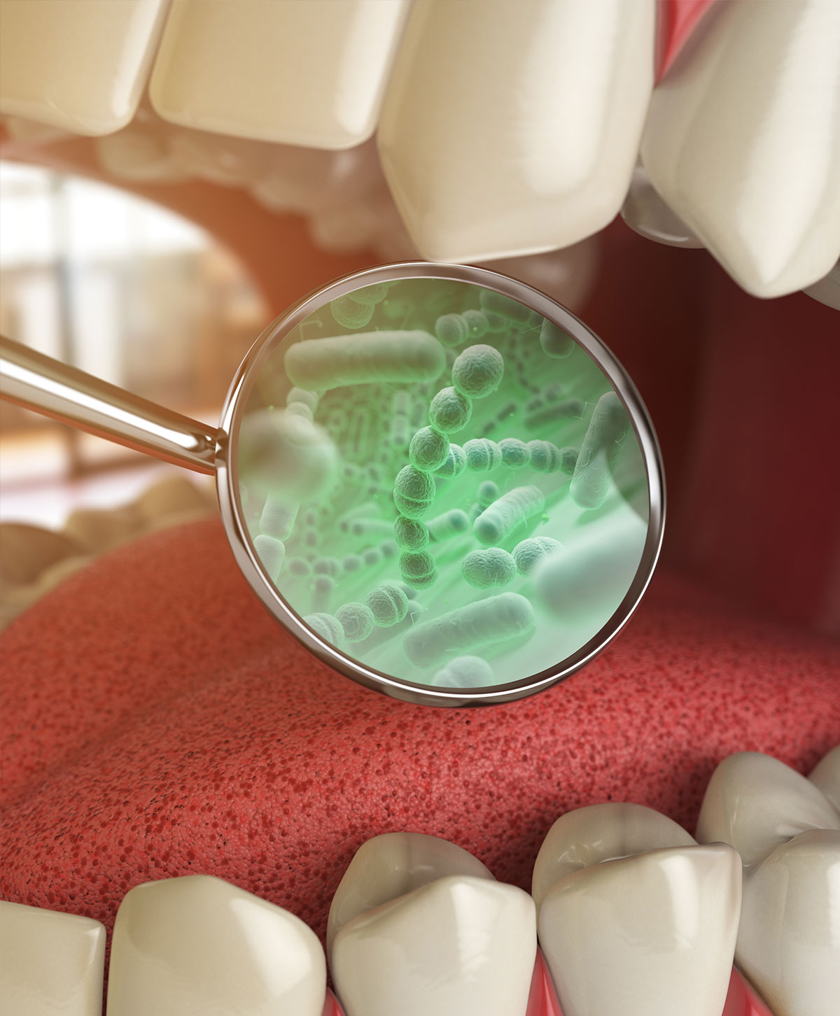 Rendering 3D che mostra i batteri intorno ai denti
